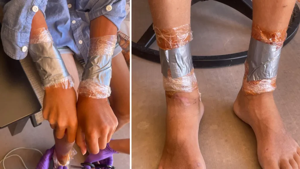 Dítě s rukama a nohama omotanýma plastovou fólií a přelepenýma lepící páskou, což naznačuje vážné fyzické týrání matkou Ruby Franke