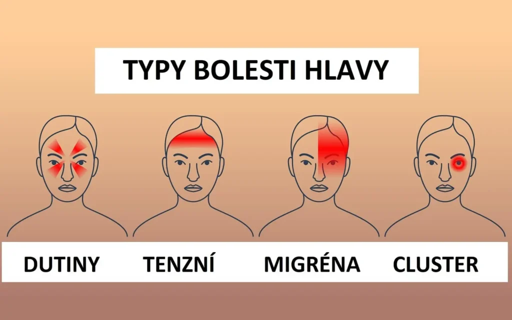 Infografika znázorňující čtyři nejčastější typy bolesti hlavy: bolesti dutin, tenzní bolesti, migrénu a cluster bolesti.