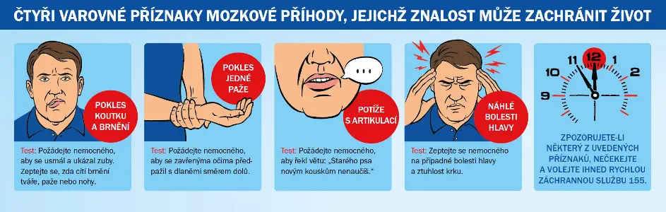 Čtyři klíčové varovné příznaky mrtvice: pokles koutku, oslabení jedné paže, potíže s artikulací a náhlé bolesti hlavy. Obrázek obsahuje pokyny, jak postupovat v případě jejich zpozorování.